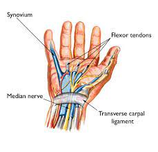 Carpal Tunnel Syndrome Causes Treatment