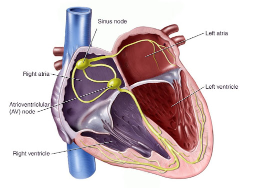 Cardiac Arrhythmia Causes Prevention Natural treatment Cardiac Arrhythmia
